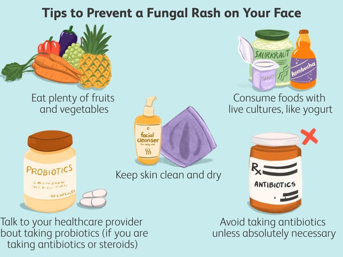 Fungal diseases are often difficult to prevent and treat, but there are some things you can do to help.
